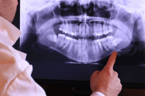Best Emergency Treatment for Dental Infections or Abscesses in Maitland, FL
