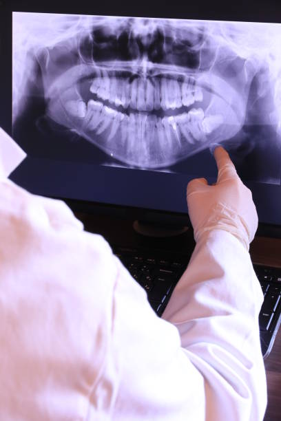 Best Emergency Tooth Extraction in Maitland, FL